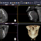Will 3D | Dental 3D Imaging Software