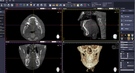 Will 3D | Dental 3D Imaging Software